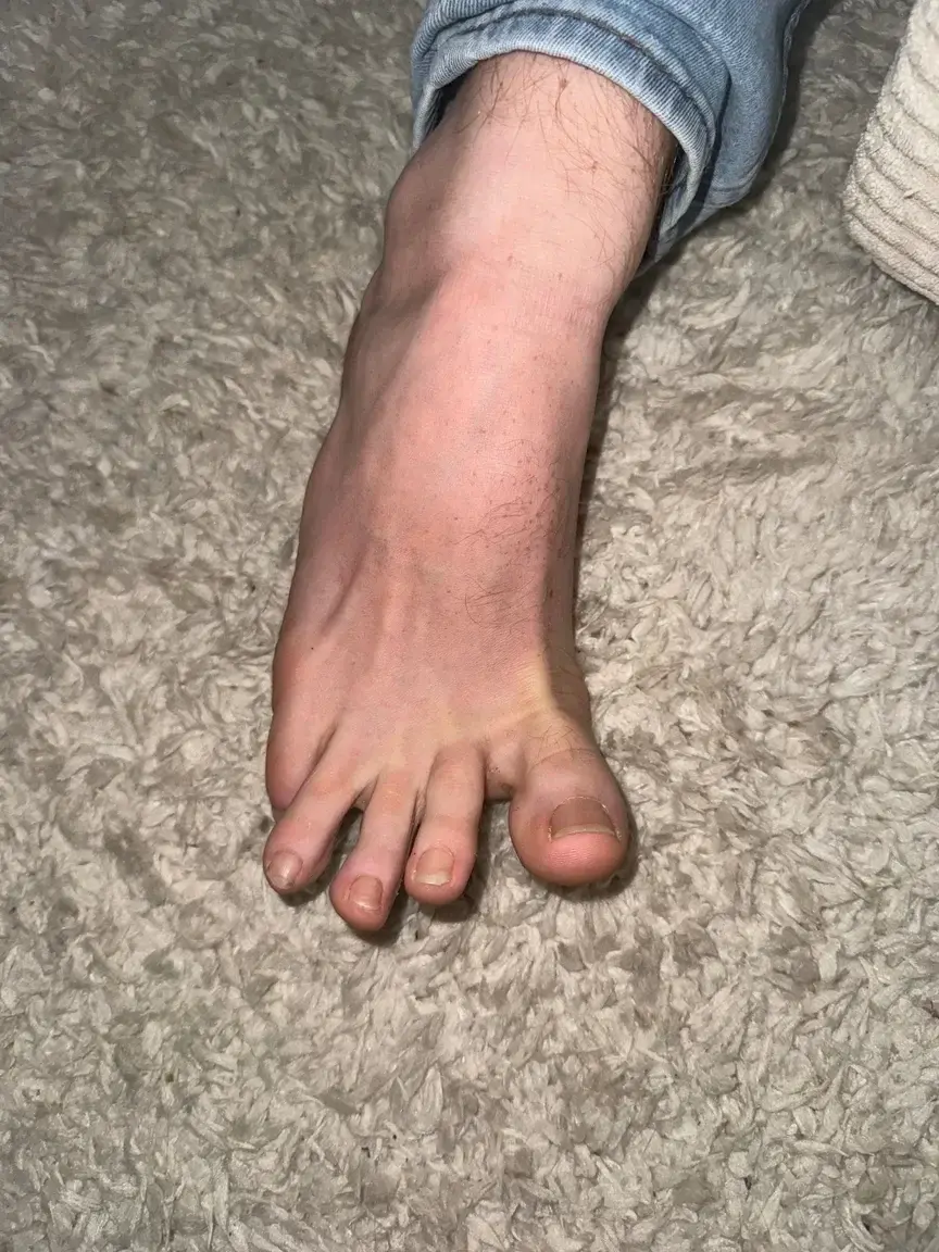 Leak & nude 3 — Onlyfoot_french