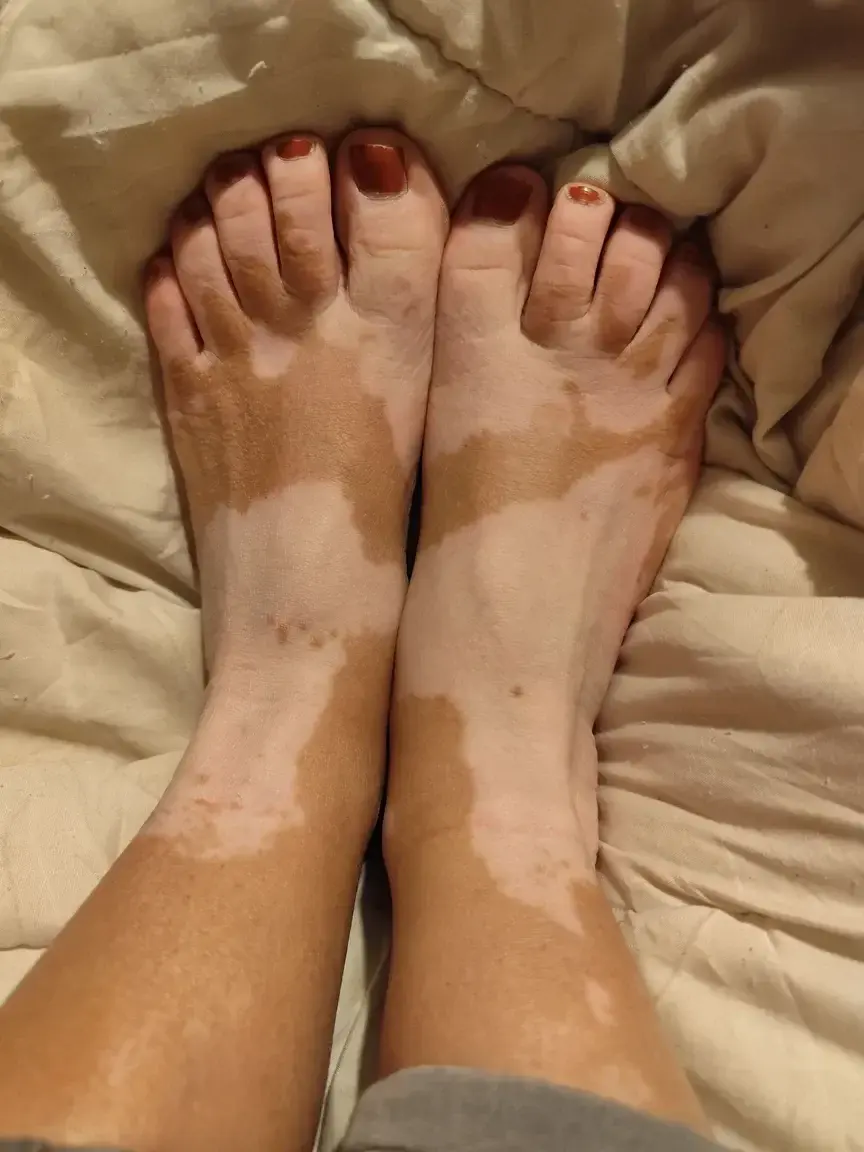 Leak & nude 1 — Viti_feet