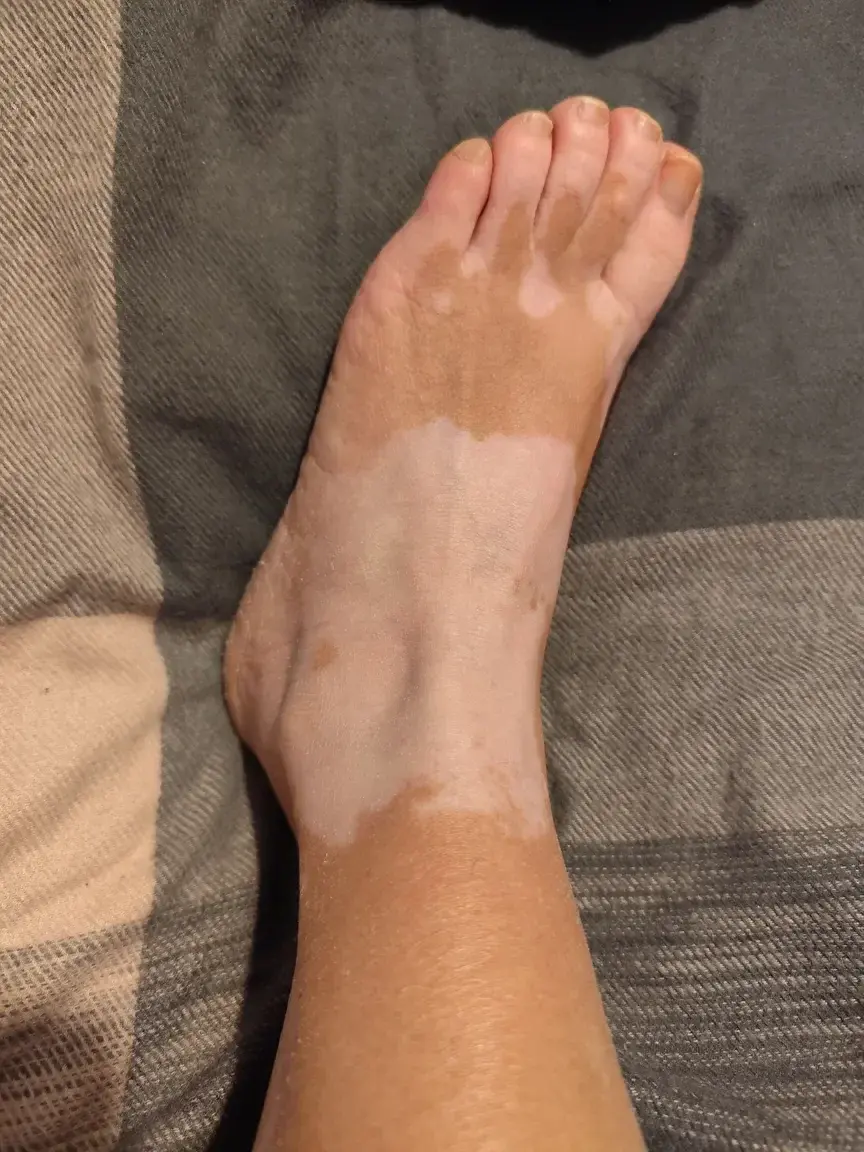 Leak & nude 3 — Viti_feet