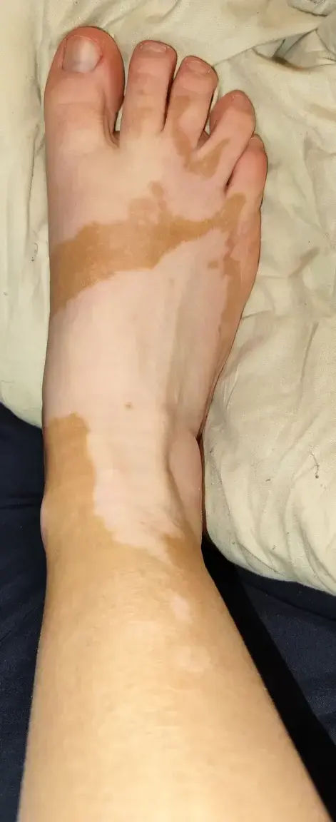 Leak & nude 4 — Viti_feet