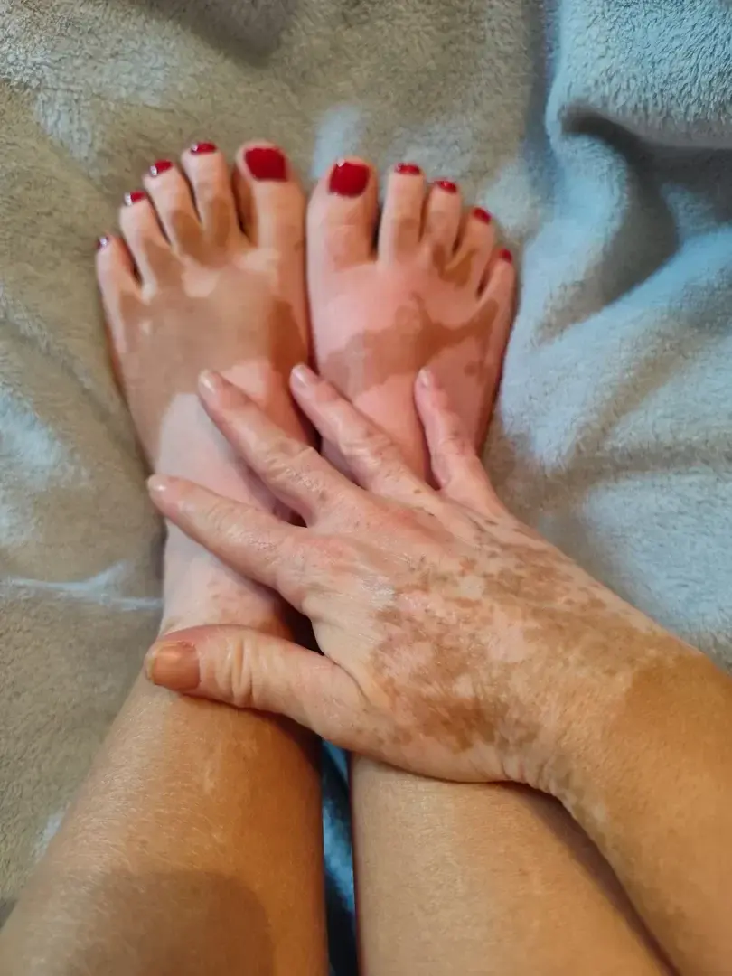 Photo de couverture de Viti_feet