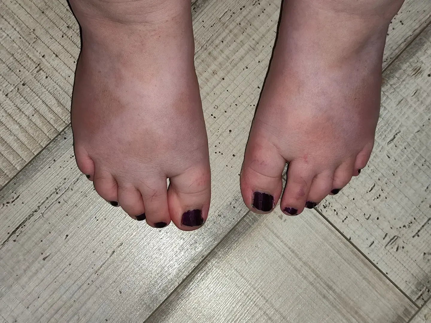Leak & nude 11 — Feet_curvy_girl