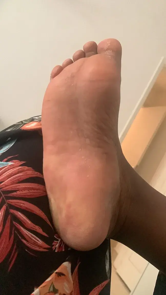 Leak & nude 3 — caps_feet