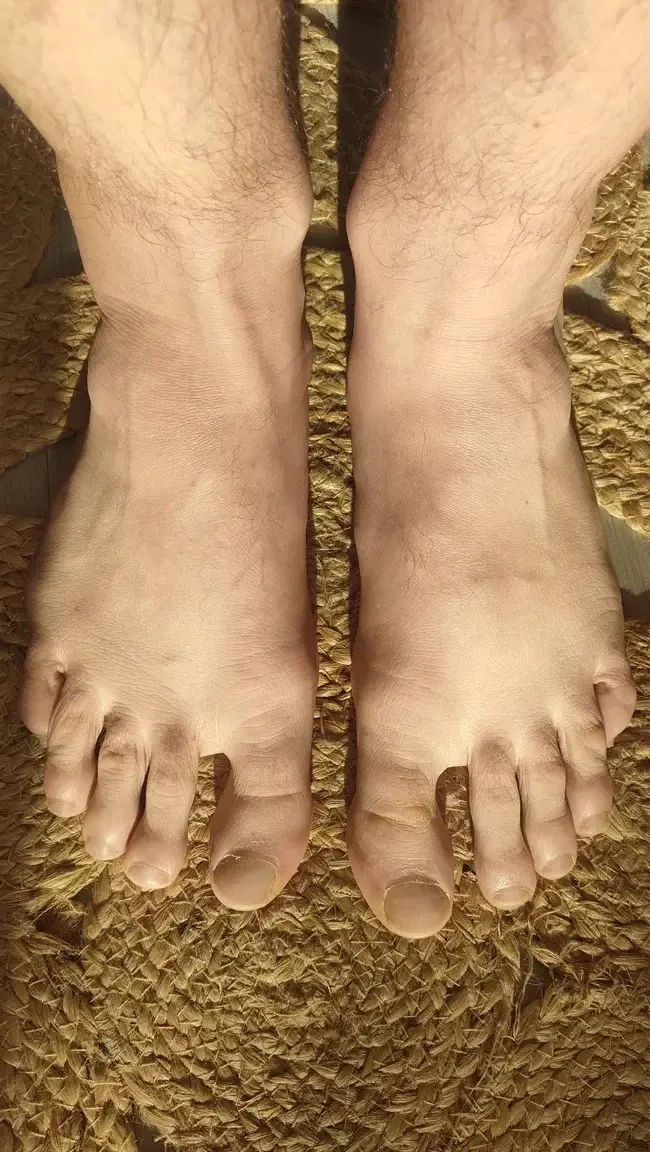 Leak & nude 1 — Hobbit_feet_