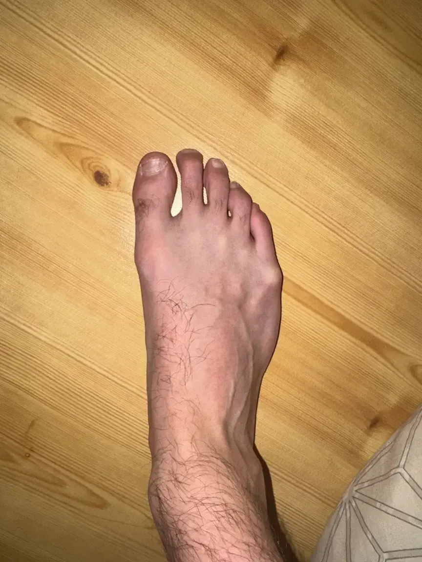 Leak & nude 1 — Couplesfeet0