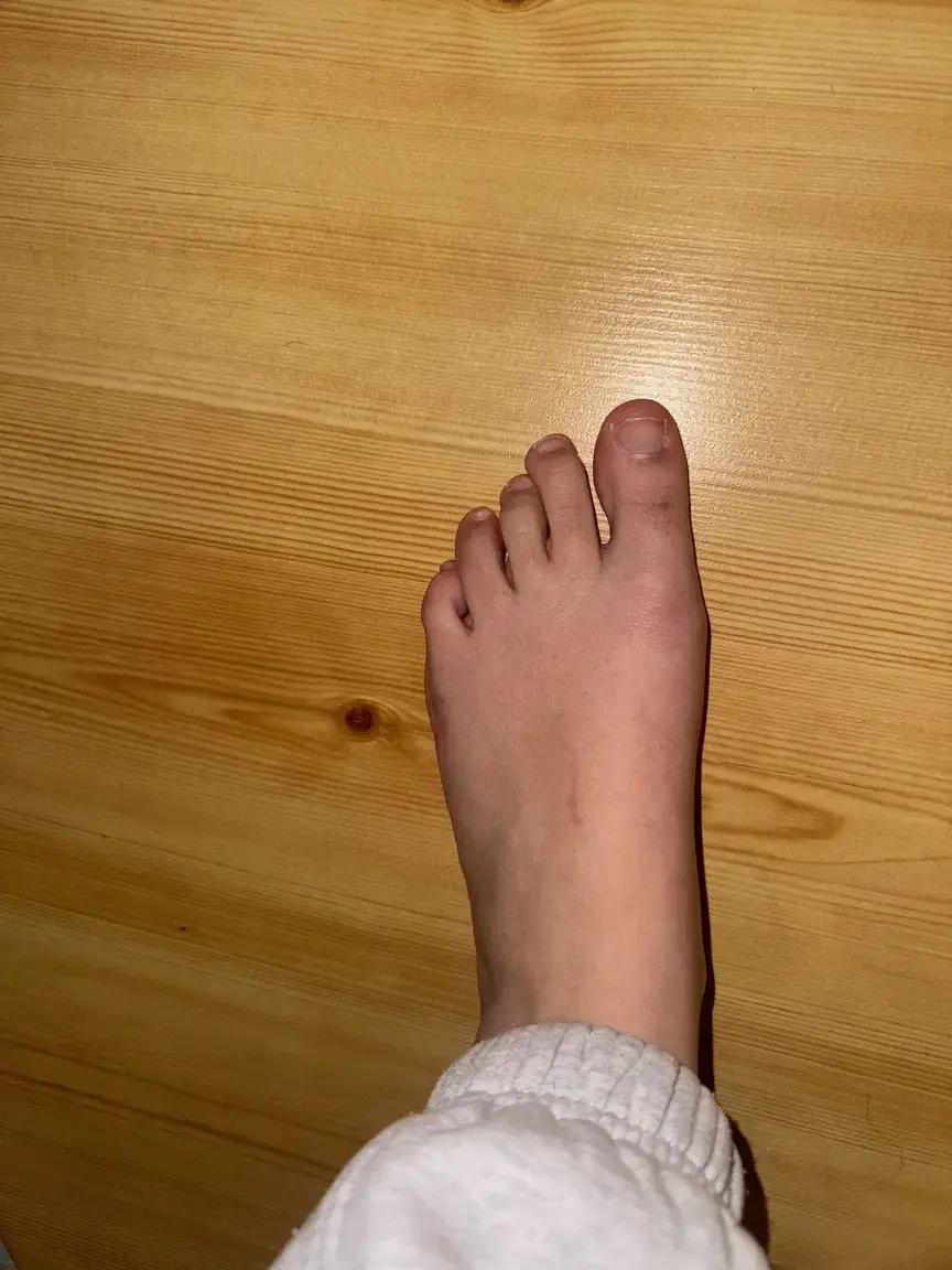 Leak & nude 2 — Couplesfeet0