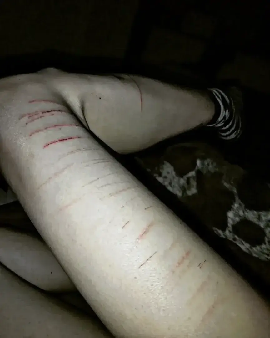bdx_sugg_x - Photo exclusive MYM 3 | French Modèles