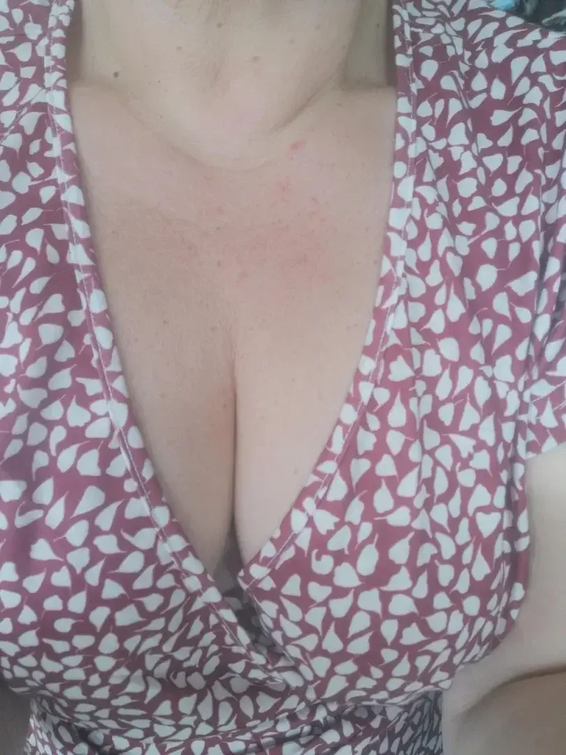 Whoopsy - Photo exclusive MYM 2 | French Modèles