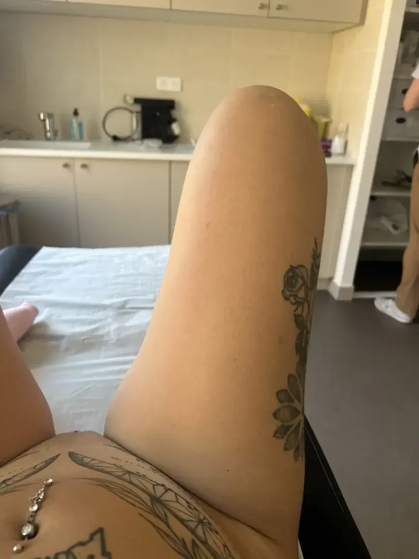chez le gyneco pour m’exciter pendant ma pose de sterlilet