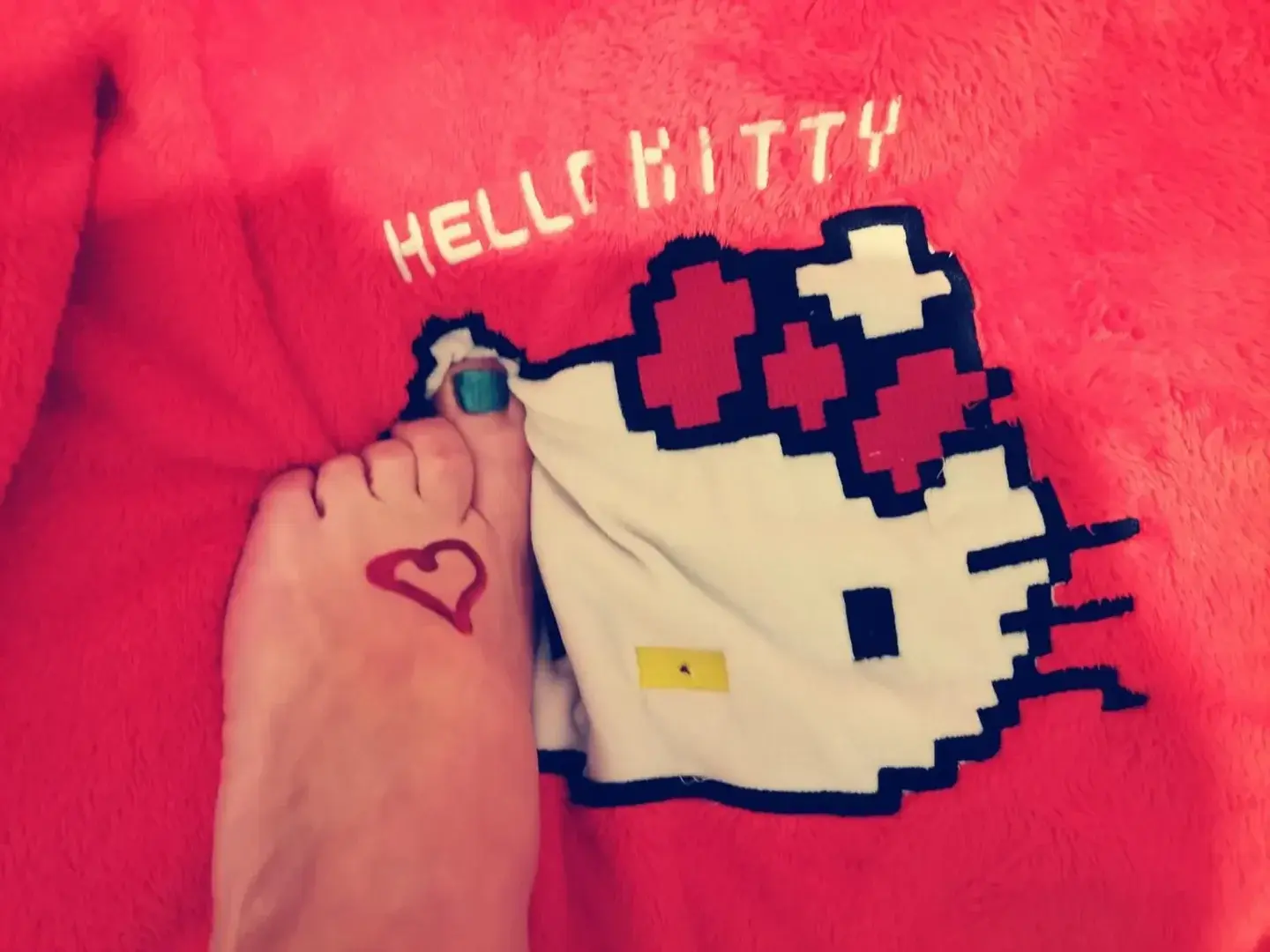 Hello.... you