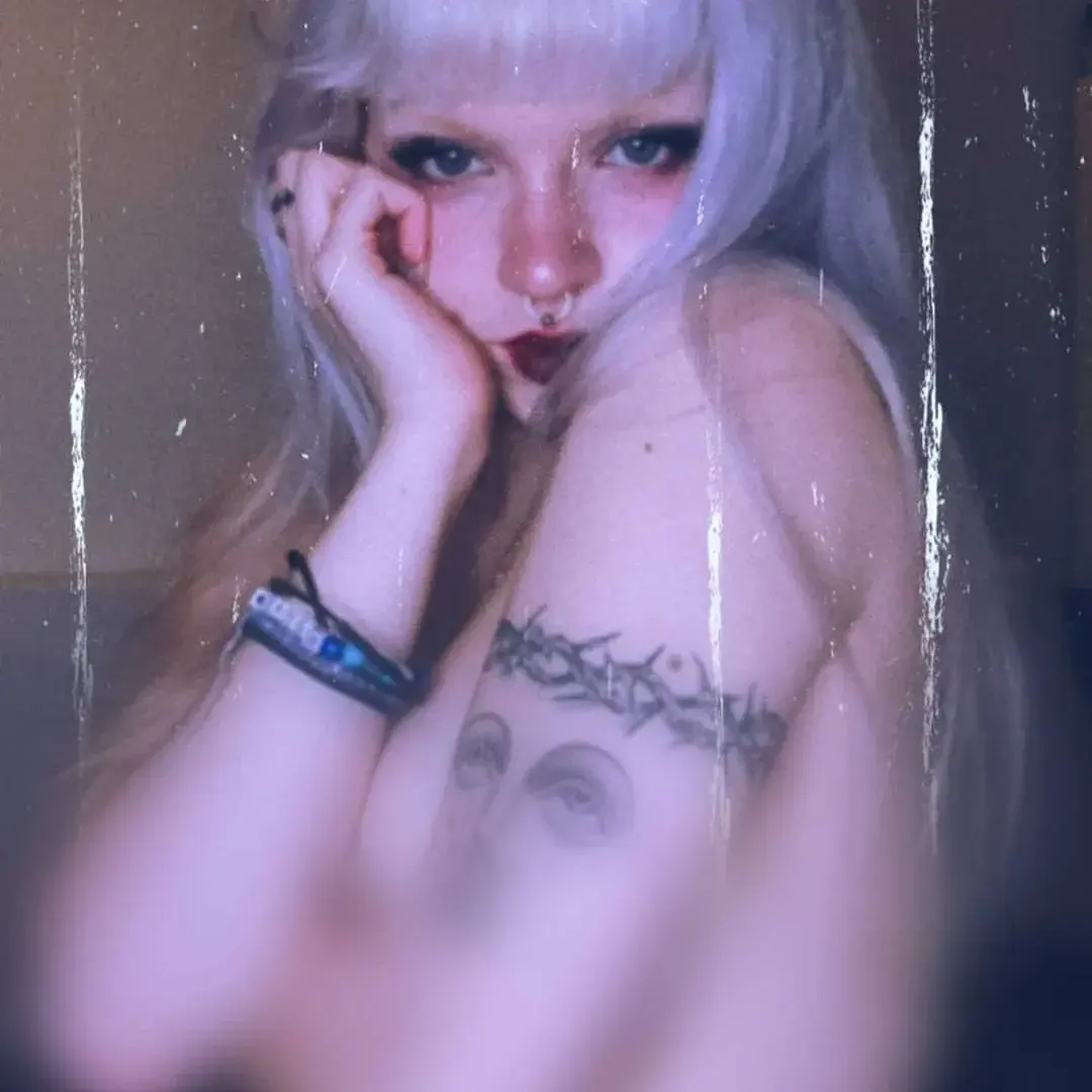 Avatar de Hysterectomie