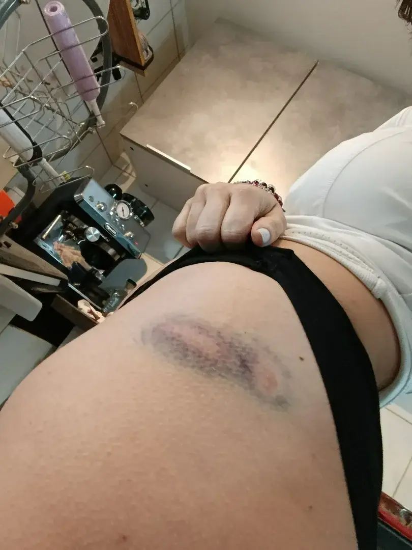Leak & nude MYM — Tutti-frutty : « Je me suis fait un bleu des ténèbres mdr ...Mais j'ai sauvé mon fils d'une potentielle chute les mamans c'est des héroïnes haha . » (MYM)