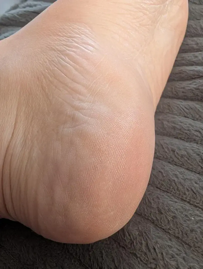 Talon de pieds#naturalfeet #feetlovers #beautifulfeet #feet #pieds #talonpieds #details