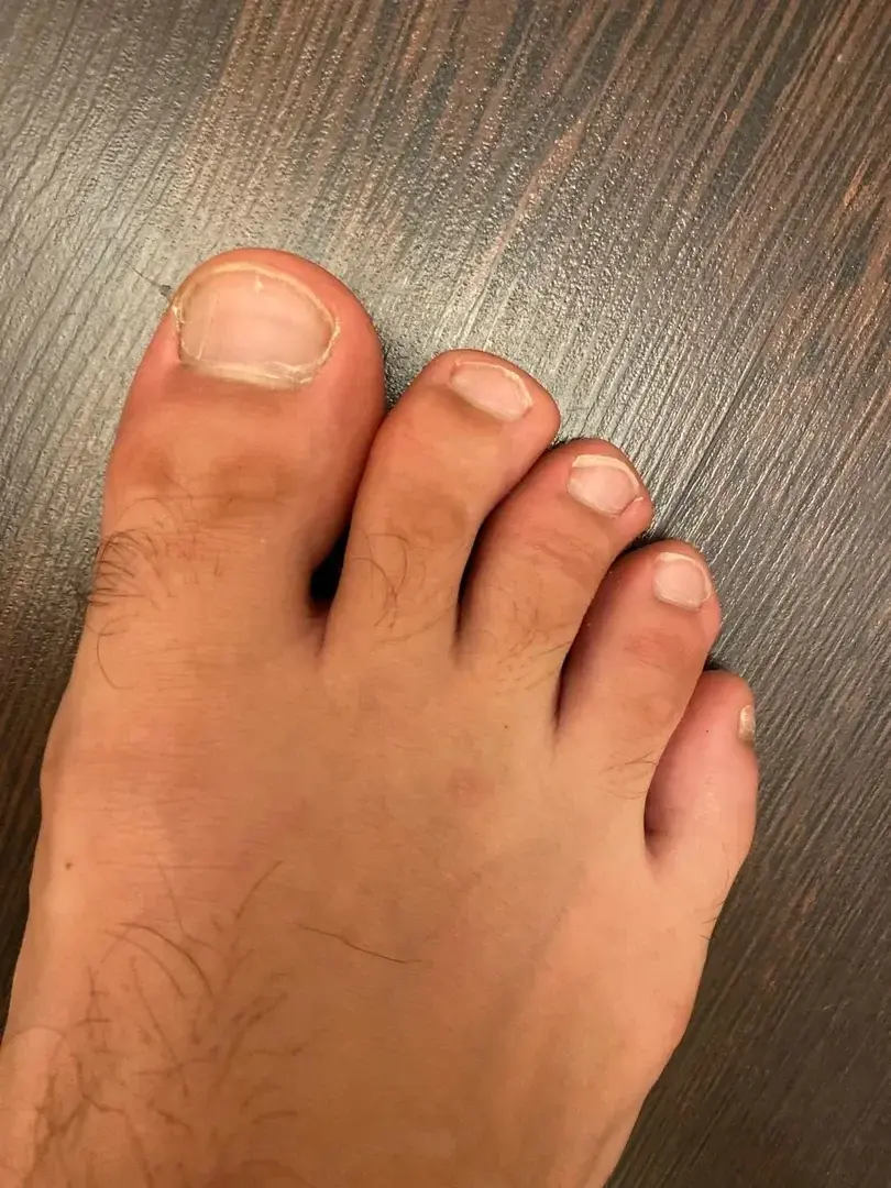 Leak & nude 1 — Feetfit_