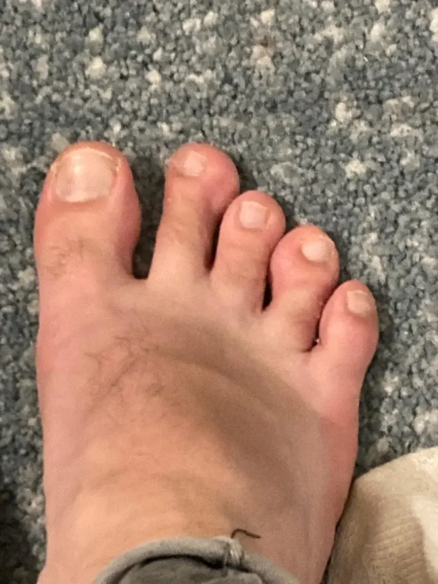 Leak & nude 4 — Footoof_