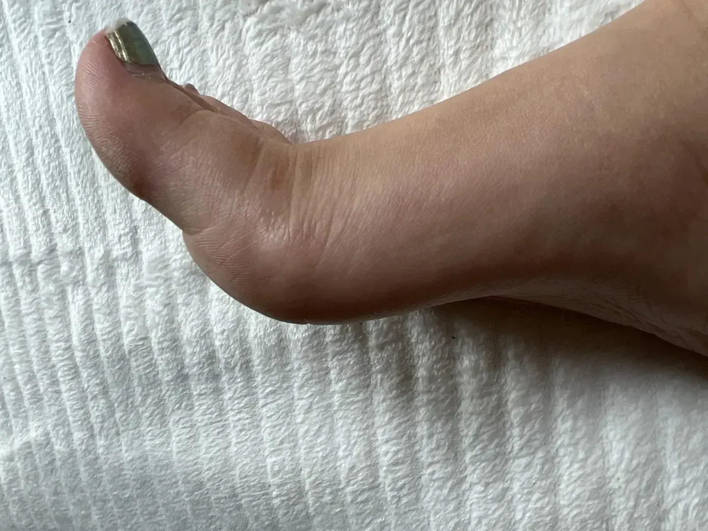 Avatar de Appafeet