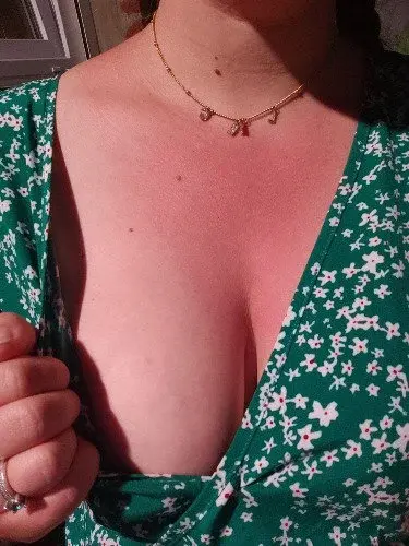 Je crois que j'ai attraper un coup de soleil... 