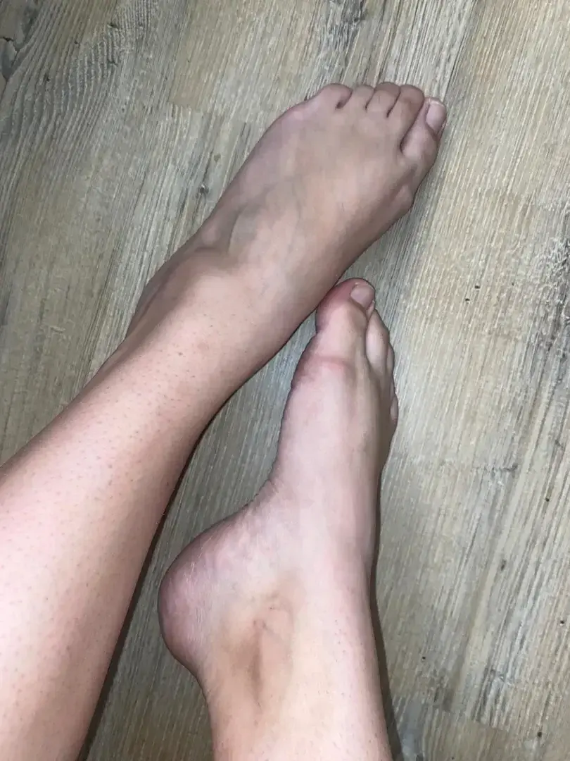 Leak & nude 1 — Footloose11