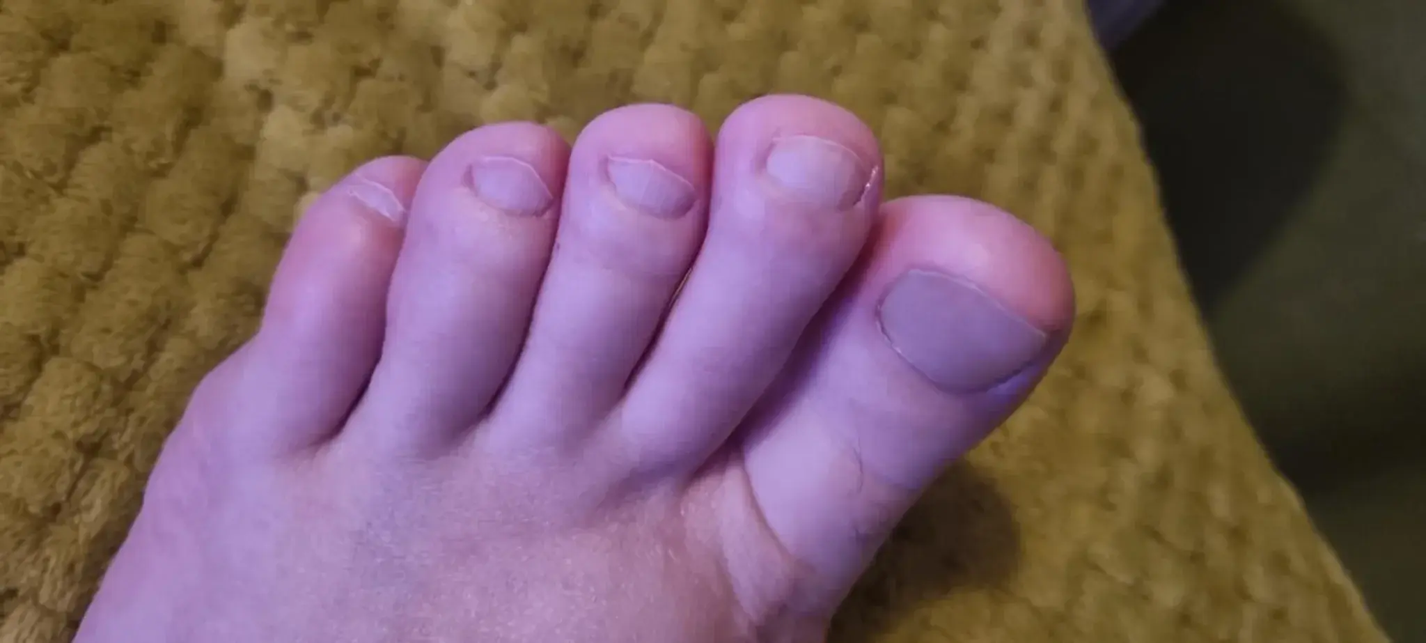 Leak & nude 3 — Abfab_feet