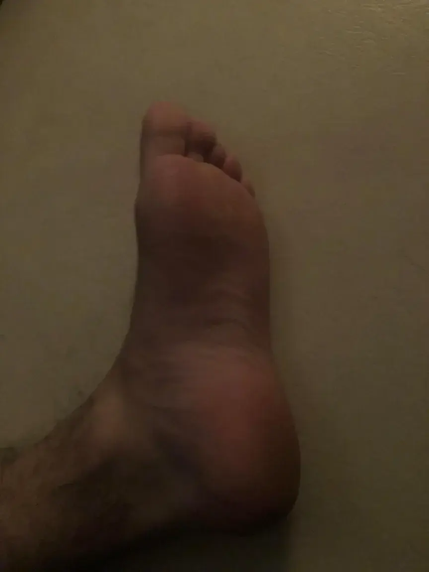 Leak & nude 2 — Pied2mec