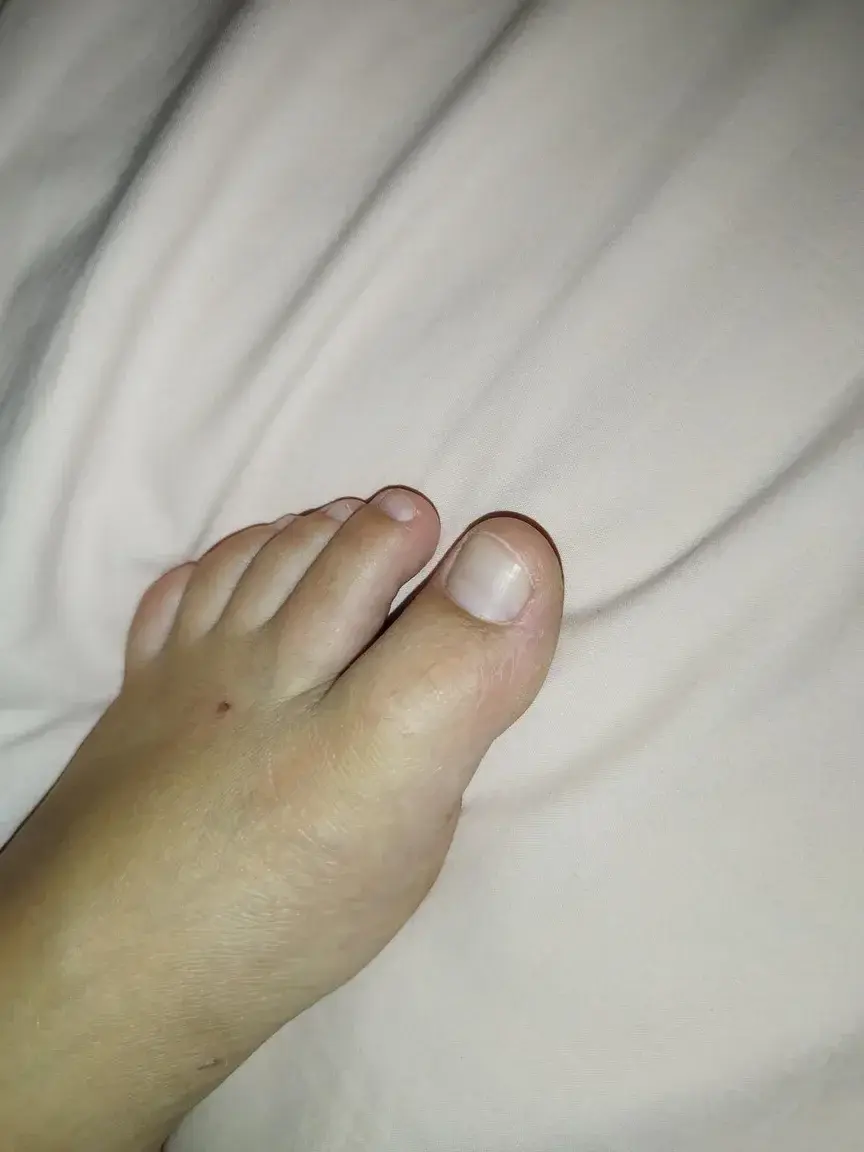 Leak & nude 3 — Lillfoot