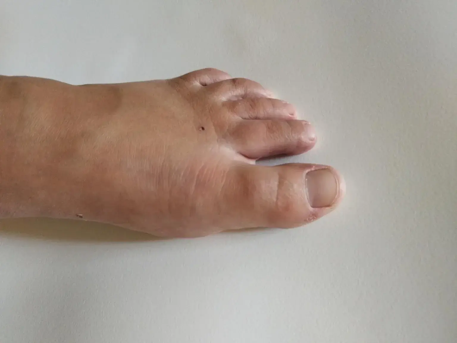 Leak & nude 5 — Lillfoot