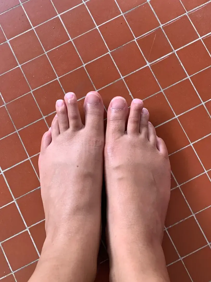 Leak & nude 4 — Pied_desiles