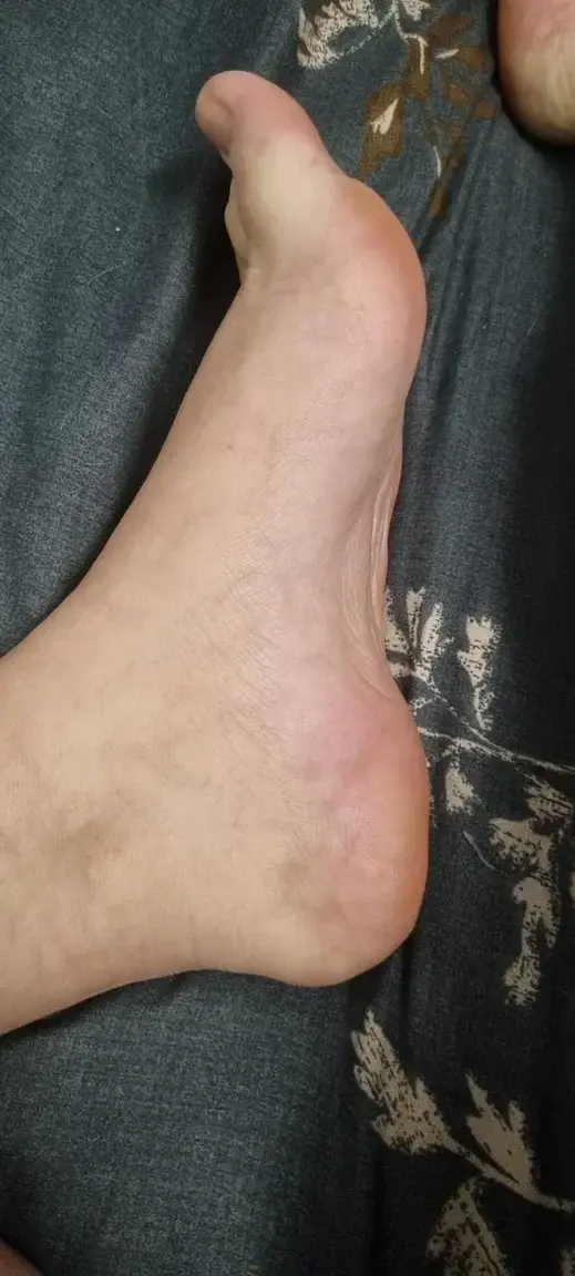Leak & nude 1 — Shyfeet99