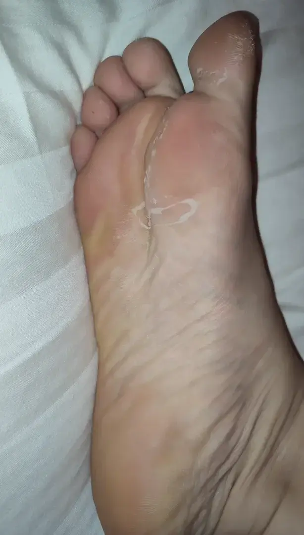 My feet really doesn't like winter at all.Need to massage them with cream twice a day and it's not enough