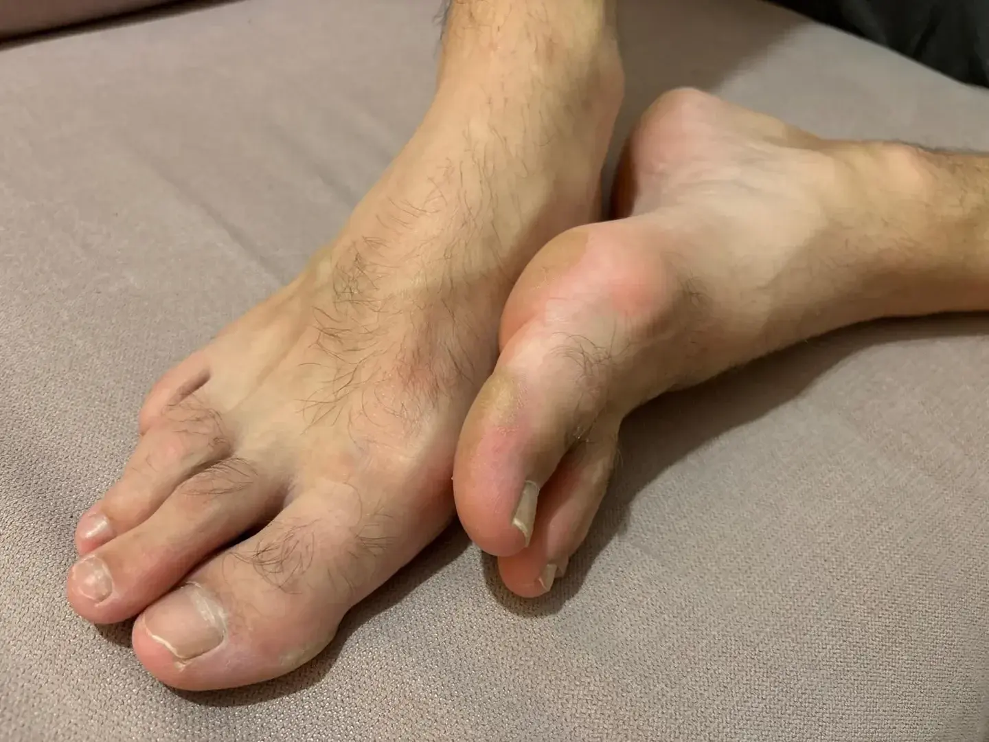 Leak & nude 1 — Mes-pieds-de-reve
