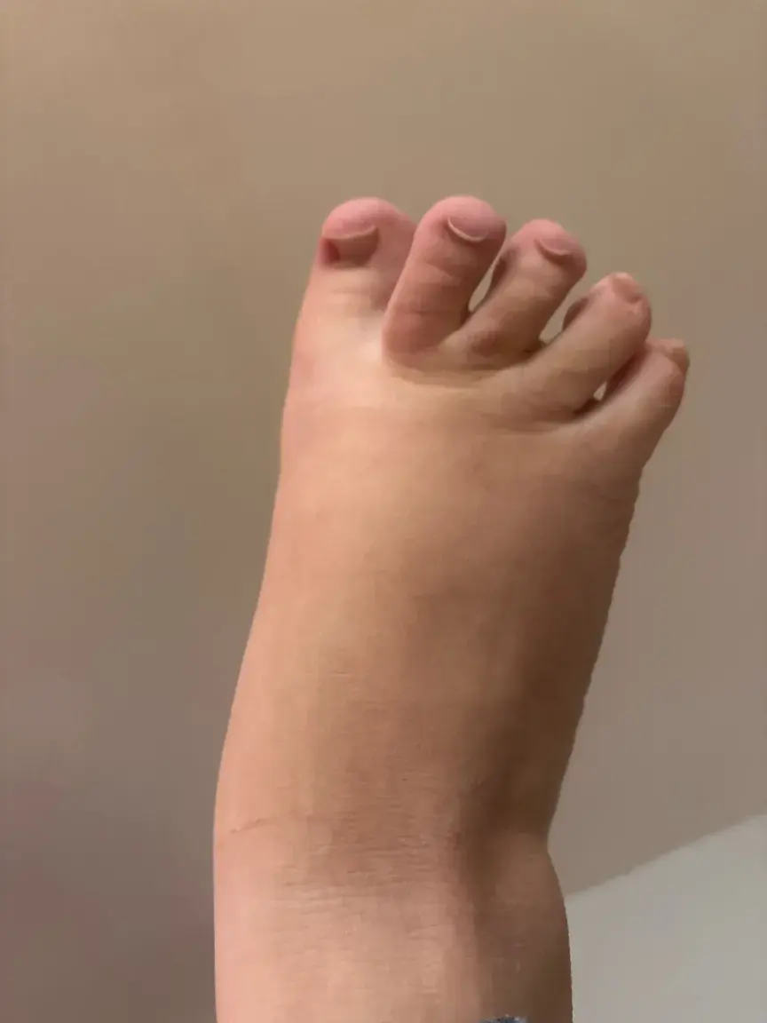 Leak & nude 2 — Uglyfeets45