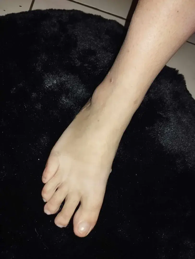 Leak & nude 1 — Les-pieds-de-meline