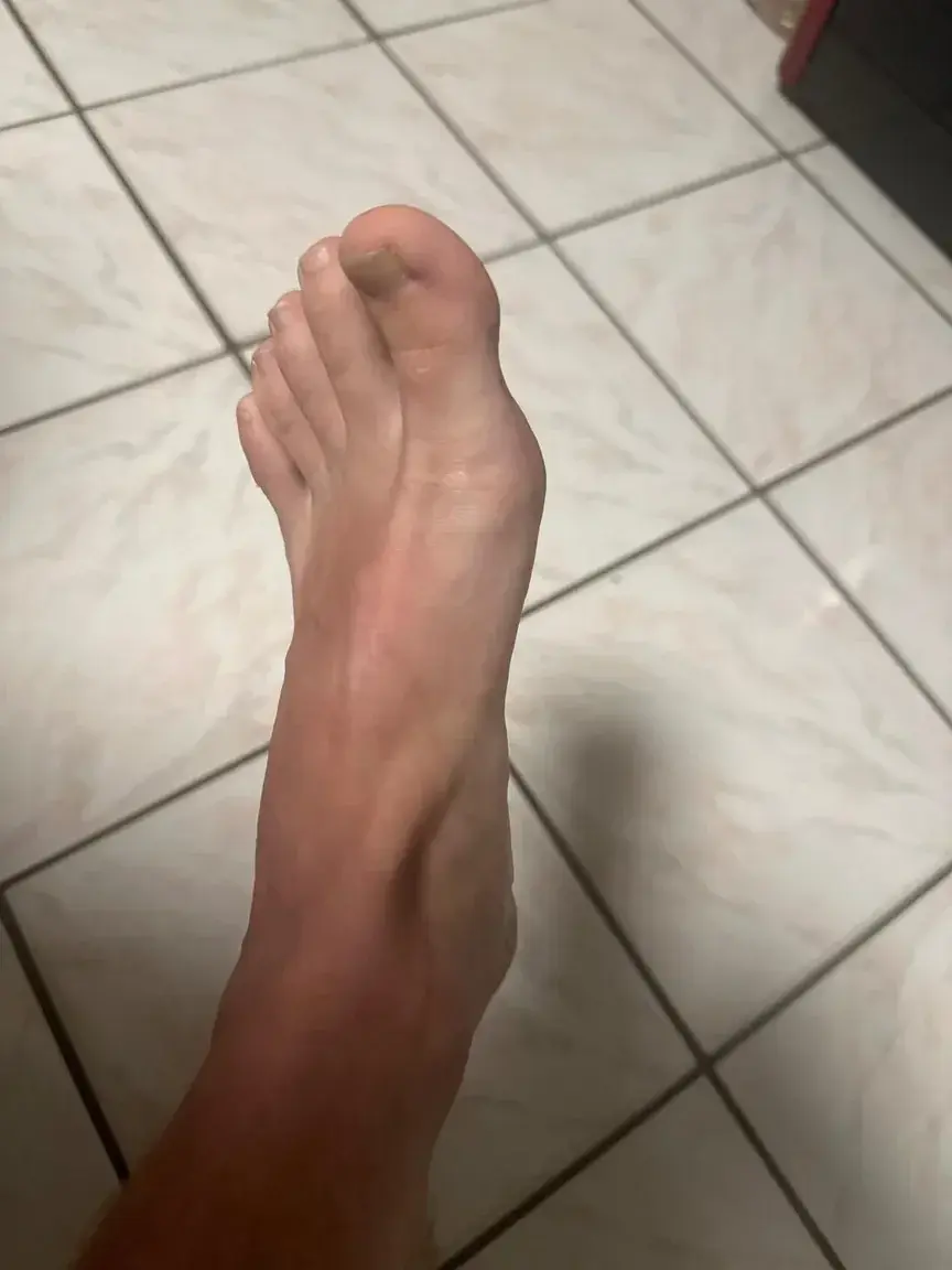 Leak & nude 1 — Chauvesourit