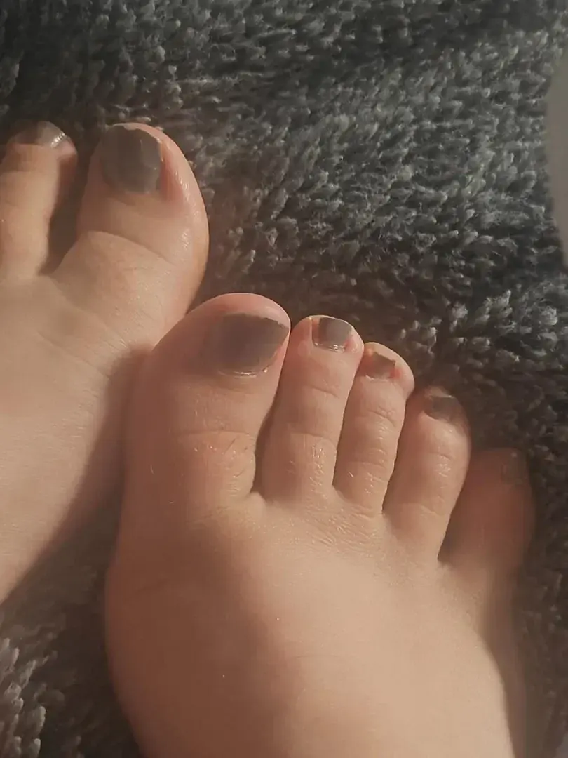 Leak & nude 2 — Seemyuglyfeet