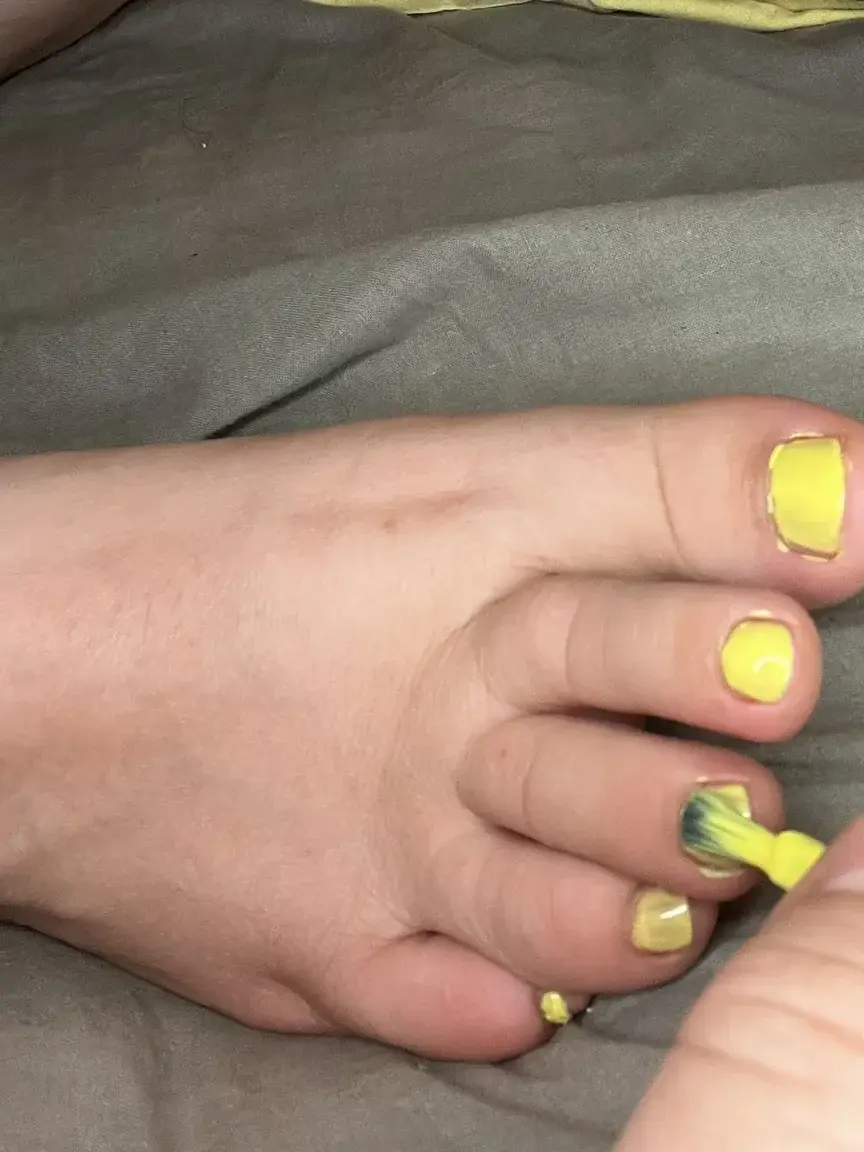 Leak & nude 6 — Scar-feets