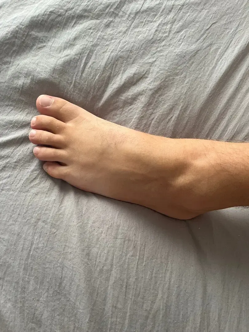 Leak & nude 2 — Vitoireetsam_pied