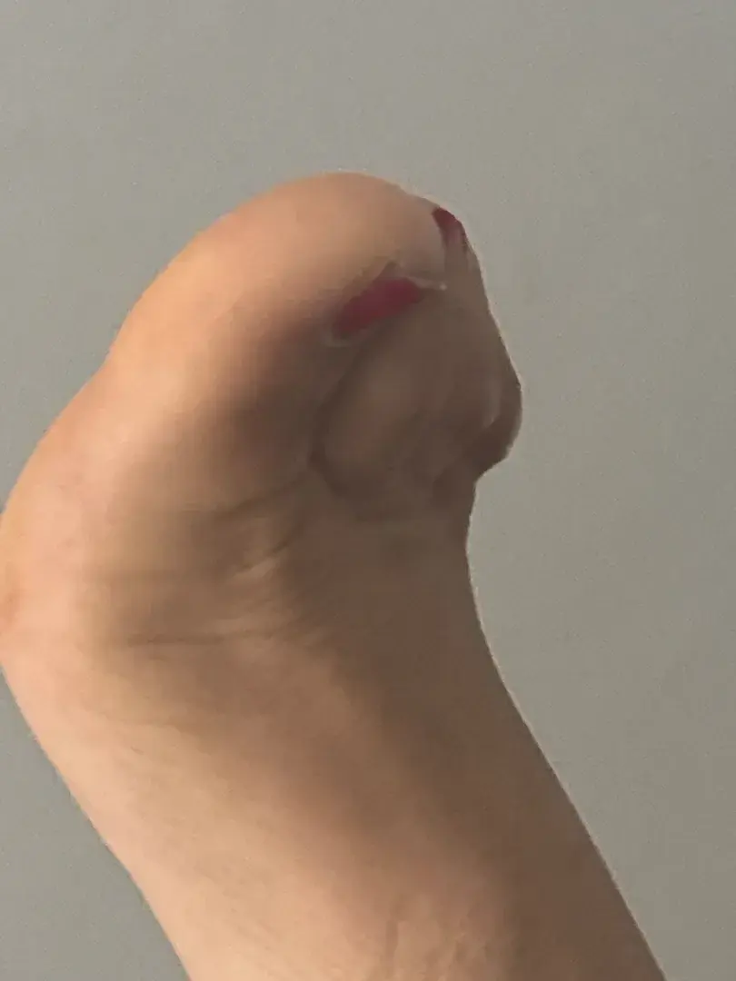 Leak & nude 1 — Enolasens_