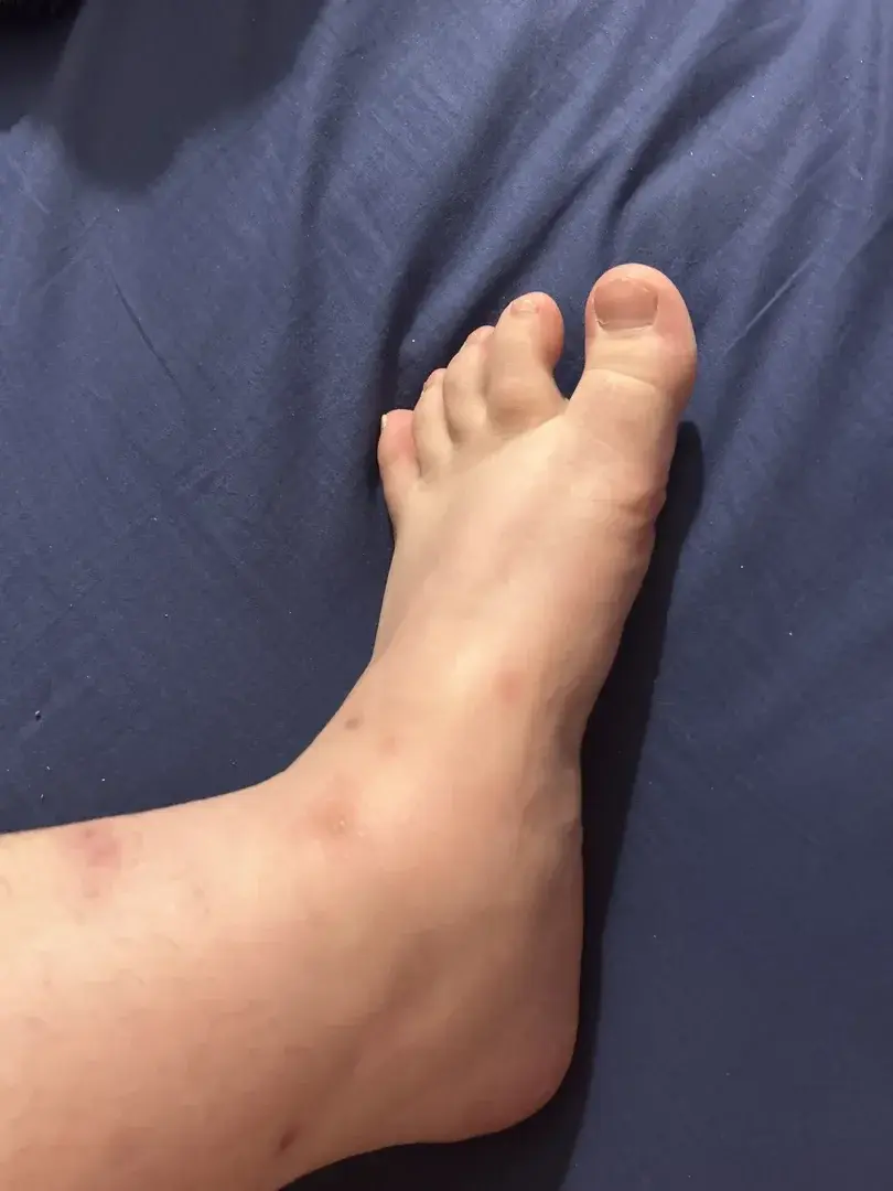 Leak & nude 1 — Lolila89_89
