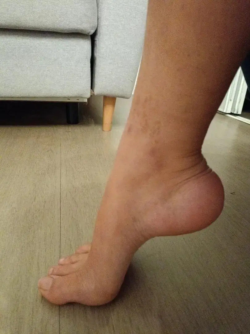 Leak & nude 1 — fruitytoe
