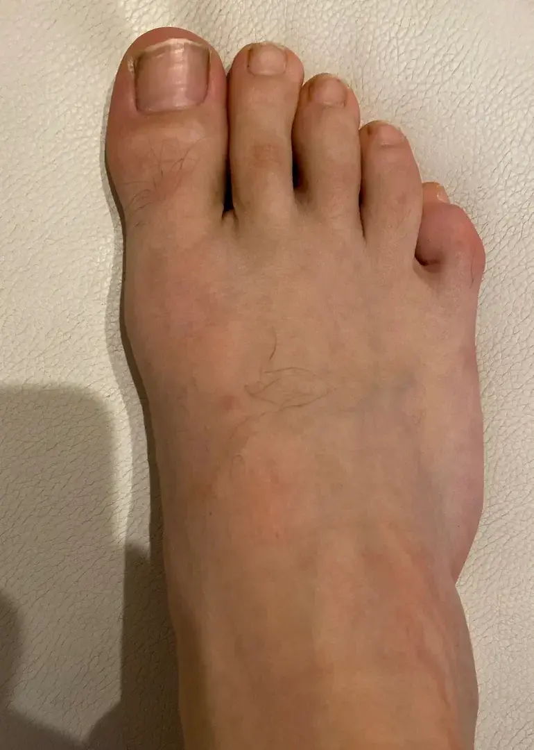 Leak & nude 1 — Monsieurfoot